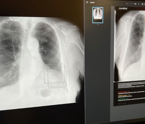 Umělá inteligence v nemocnici Tábor: Carebot přináší zásadní pokrok v diagnostice 